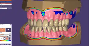 Nua Clinica Dental - Planificación digital