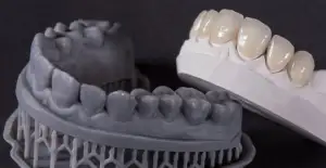 Nua Clinica Dental - Uso de sistema cad_cam